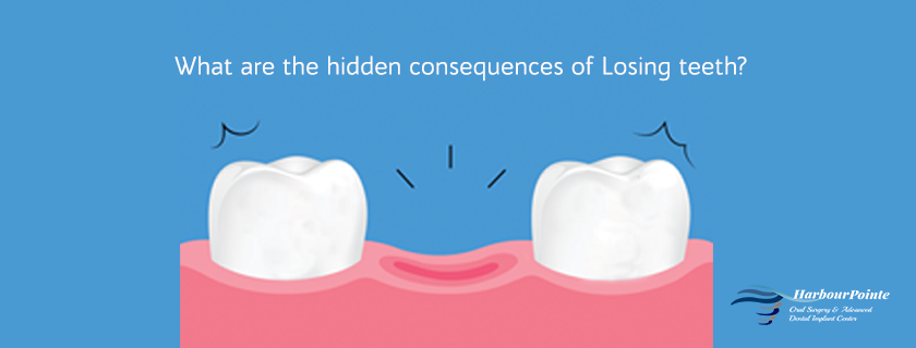Consequences of Losing teeth