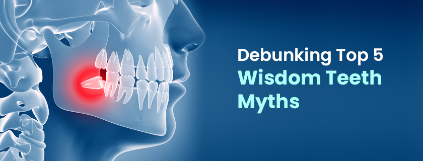 wisdom teeth myths
